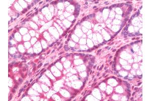 Anti-STUB1 / CHIP antibody IHC staining of human colon. (STUB1 Antikörper  (AA 17-303))