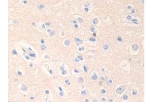 DAB staining on IHC-P; Samples: Human Cerebrum Tissue (Epsin 1 Antikörper  (AA 279-437))