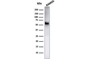 Western Blot Analysis of Ramos cell lysate using CD86 Rabbit Recombinant Monoclonal Antibody (C86/2160R). (Rekombinanter CD86 Antikörper)