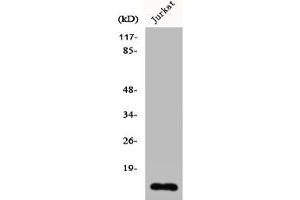 Western Blot analysis of Jurkat cells using Cdc42EP5 Polyclonal Antibody (CDC42EP5 Antikörper  (N-Term))