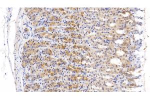 Immunohistochemistry (IHC) image for anti-Tenascin C (TNC) (AA 513-621) antibody (ABIN7434452)