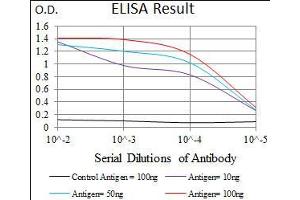 Black line: Control Antigen (100 ng), Purple line: Antigen(10 ng), Blue line: Antigen (50 ng), Red line: Antigen (100 ng), (Cytokeratin 5 Antikörper  (AA 316-590))