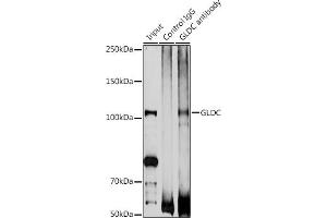 Immunoprecipitation analysis of 200 μg extracts of DU145 cells using 3 μg GLDC antibody (ABIN6132011, ABIN6141119, ABIN6141120 and ABIN6225260).