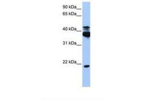 Image no. 1 for anti-serine/threonine Kinase 38 (STK38) (AA 368-417) antibody (ABIN6738495) (STK38 Antikörper  (AA 368-417))
