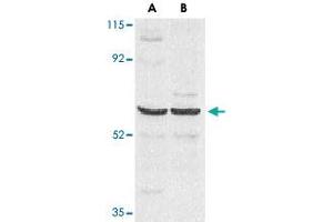 Western blot analysis of CARD9 expression in human MDA-MB-361 (A) and PC-3 (B) cell lysate with CARD9 polyclonal antibody  at 2. (CARD9 Antikörper  (AA 521-536))