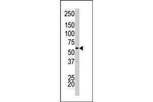 The PCTK2 polyclonal antibody  is used in Western blot to detect PCTK2 in HeLa cell lysate. (CDK17 Antikörper  (N-Term))