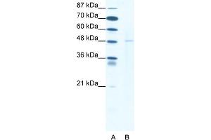 WB Suggested Anti-DEK Antibody Titration:  1. (DEK Antikörper  (N-Term))