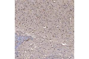 IHC analysis of NOB1 using anti-NOB1 antibody (ABIN7599344). (NOB1 Antikörper  (AA 1-389))