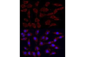 Immunofluorescence analysis of NIH/3T3 using Phospho-PDH-S293 Rabbit mAb (ABIN7269768) at dilution of 1:100 (40x lens). (PDHA1 Antikörper  (pSer293))