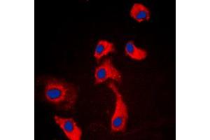 Immunofluorescent analysis of GPR116 staining in HEK293T cells. (G Protein-Coupled Receptor 116 Antikörper  (C-Term))