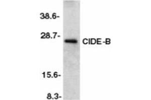 Image no. 1 for anti-Cell Death-Inducing DFFA-Like Effector B (CIDEB) (AA 204-219) antibody (ABIN201953) (CIDEB Antikörper  (AA 204-219))