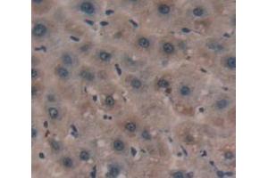 IHC-P analysis of Human Tissue, with DAB staining. (SERPINA3 Antikörper  (AA 235-394))