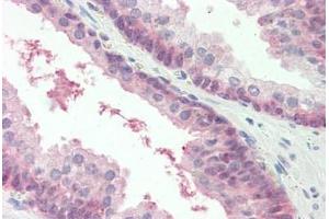 Human Prostate: Formalin-Fixed, Paraffin-Embedded (FFPE) (MARCH2 Antikörper  (AA 146-195))