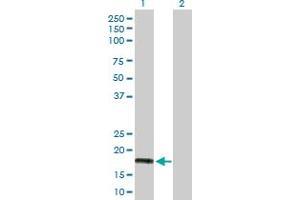 Western Blot analysis of IFNA5 expression in transfected 293T cell line by IFNA5 MaxPab polyclonal antibody. (IFNA5 Antikörper  (AA 1-189))