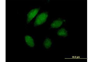 Immunofluorescence of purified MaxPab antibody to JTV1 on HeLa cell. (AIMP2 Antikörper  (AA 1-320))