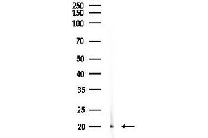 anti-Syndecan 2 (SDC2) (C-Term) antibody