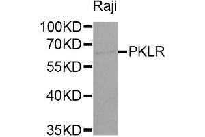 Western Blotting (WB) image for anti-Pyruvate Kinase, Liver and RBC (PKLR) antibody (ABIN1874148) (PKLR Antikörper)