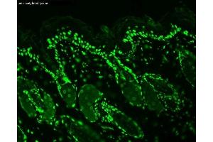 Immunohistochemistry analysis using Mouse Anti-Acetylated Lysine Monoclonal Antibody, Clone 7F8 (ABIN361802 and ABIN361803). (Lysine (lys) (acetylated) Antikörper)