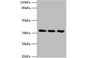 Western blot All lanes: ACVR1 antibody at 6 μg/mL Lane 1: A549 whole cell lysate Lane 2: HepG2 whole cell lysate Lane 3: Mouse gonad tissue Secondary Goat polyclonal to rabbit IgG at 1/10000 dilution Predicted band size: 39 kDa Observed band size: 39 kDa (ACVR1 Antikörper  (AA 20-125))