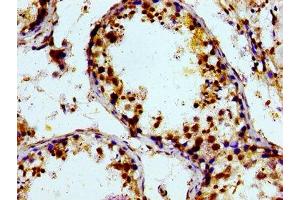 Immunohistochemistry (IHC) image for anti-Prostaglandin Reductase 2 (PTGR2) (AA 206-282) antibody (ABIN7164870)