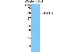 Western Blotting (WB) image for anti-Peroxiredoxin 3 (PRDX3) (AA 64-257) antibody (ABIN1860307) (Peroxiredoxin 3 Antikörper  (AA 64-257))
