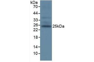 Western Blotting (WB) image for anti-T Cell Immunoreceptor with Ig and ITIM Domains (TIGIT) (AA 28-246) antibody (ABIN7439465)