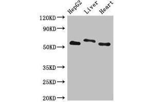 Western Blot Positive WB detected in: HepG2 whole cell lysate, Rat liver tissue, Mouse heart tissue All lanes: SLC13A5 antibody at 2. (SLC13A5 Antikörper  (AA 156-204))