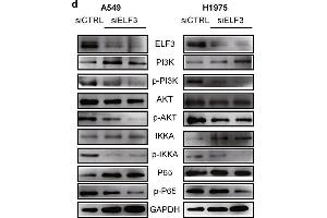 ELF3 can be induced by IL1B and promotes tumor growth through PI3K/AKT/NF-κB pathway. (ELF3 Antikörper  (AA 1-280))