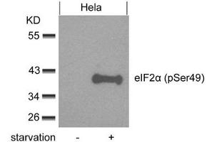 Western blot analysis of extracts from Hela cells untreated or treated with starvation using eIF2a(phospho-Ser49) Antibody. (EIF2S1 Antikörper  (pSer49))