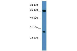KBTBD8 antibody (70R-10021) used at 0. (KBTBD8 Antikörper  (N-Term))