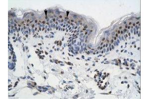 Image no. 1 for anti-General Transcription Factor III (GTF2I) (AA 208-257) antibody (ABIN6735929) (GTF2I Antikörper  (AA 208-257))