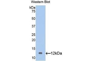 Detection of Recombinant S100, Rat using Polyclonal Antibody to S100 Calcium Binding Protein (S100) (S100 Protein (S100) (AA 1-94) Antikörper)
