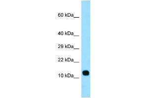 WB Suggested Anti-LCE3C Antibody Titration: 1. (LCE3C Antikörper  (Middle Region))