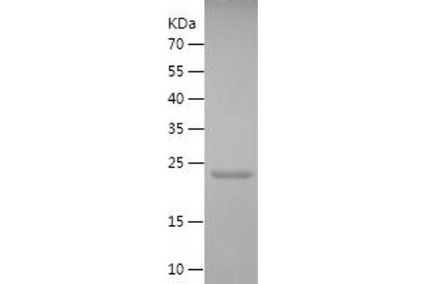 Caspase 4 Protein (AA 80-270) (His tag)