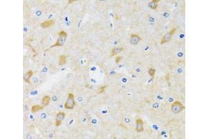 Immunohistochemistry of paraffin-embedded Mouse brain using HSPH1 Polyclonal Antibody at dilution of 1:100 (40x lens). (HSPH1 Antikörper)