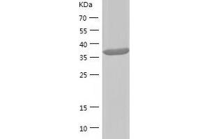 SAE1 Protein (AA 1-346) (His tag)