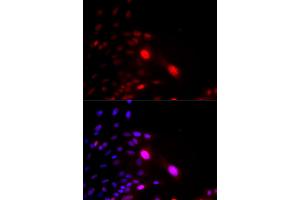 Immunofluorescence analysis of U2OS cells using DDB2 antibody (ABIN5970947). (DDB2 Antikörper)