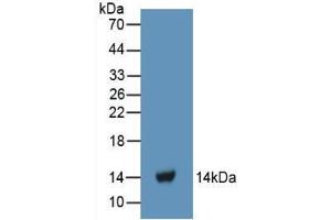 Western blot analysis of recombinant Human FGa. (FGA Antikörper  (AA 124-214))