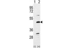 Western blot analysis of BMP7 antibody and 293 cell lysate either nontransfected (Lane 1) or transiently transfected with the BMP7 gene (2). (BMP7 Antikörper  (AA 15-44))