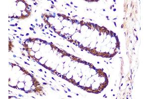 Immunohistochemistry of paraffin-embedded human colon using PSM Rabbit mAb (ABIN7269600) at dilution of 1:100 (40x lens).