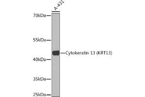 Western blot analysis of extracts of A-431 cells, using Cytokeratin 13 (Cytokeratin 13 (KRT13)) Rabbit pAb (ABIN7268090) at 1:1000 dilution. (Cytokeratin 13 Antikörper  (AA 269-458))