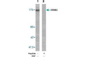 Western blot analysis of extracts from MDA-MB-231 cells using ERBB2 polyclonal antibody  . (ErbB2/Her2 Antikörper)