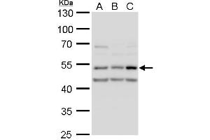 WB Image CaMK2D antibody detects CaMK2D protein by western blot analysis. (CAMK2D Antikörper)