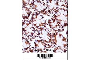 AIP Antibody immunohistochemistry analysis in formalin fixed and paraffin embedded human rectum tissue followed by peroxidase conjugation of the secondary antibody and DAB staining. (AIP Antikörper  (C-Term))