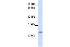 Western Blotting (WB) image for anti-Chromosome 12 Open Reading Frame 49 (C12orf49) antibody (ABIN2459339) (C12orf49 Antikörper)