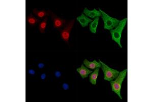 ABIN6261830 and ABIN6278360 staining Hela cells by IF/ICC.