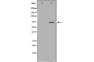 Western blot analysis of Hela whole cell lysates, using SDHA Antibody. (SDHA Antikörper  (Internal Region))