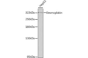 Western blot analysis of extracts of HepG2 cells, using Desmoplakin antibody (ABIN6134105, ABIN6139837, ABIN6139839 and ABIN6217243) at 1:800 dilution.