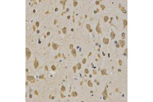 Immunohistochemistry of paraffin-embedded rat brain using Trimethyl-Histone H3-K4 antibody (ABIN5969804) at dilution of 1/200 (40x lens). (Histone 3 Antikörper  (H3K4me3))