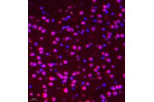 Immunofluorescence of paraffin embedded mouse brain using DGKI (ABIN7073721) at dilution of 1:650 (400x lens) (DGKI Antikörper)
